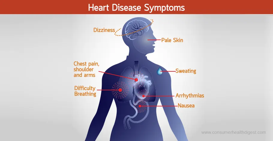 Signs And Symptoms Of Heart Disease