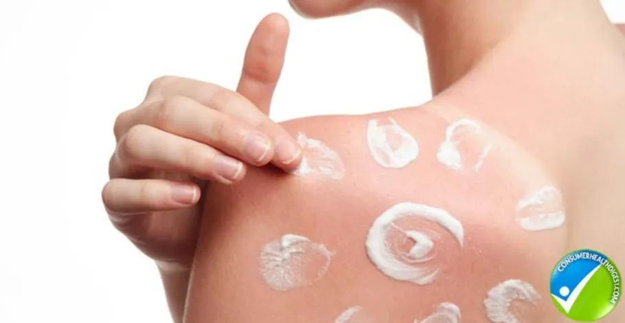Topical Skin Treatment