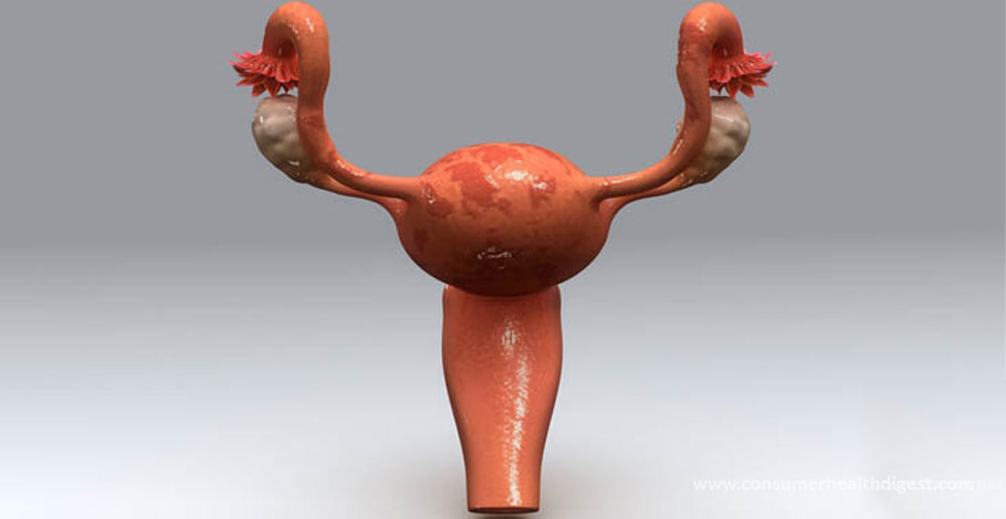 Treatments for Vaginal Polyps