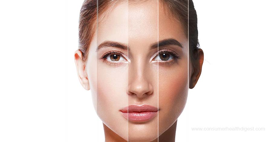 What causes uneven skin tone