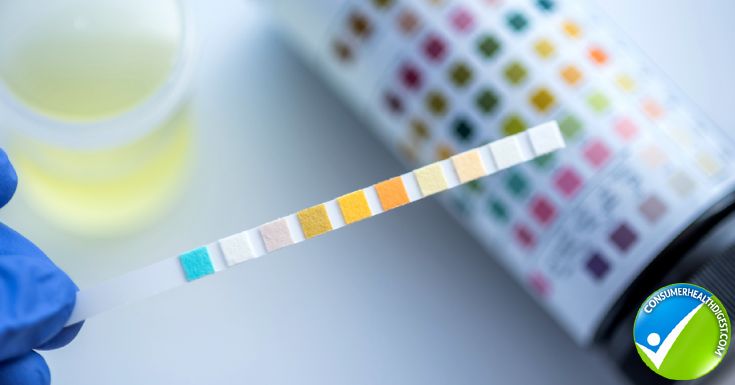 Urinalysis