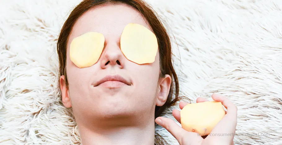 use potato slices to treat puffy eyes