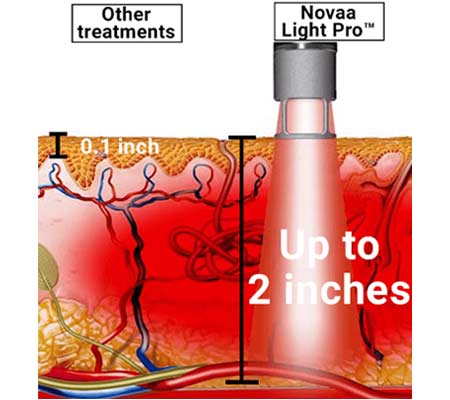 Novaa Light Max Xl 300w Novaa Light Max Xl 300w