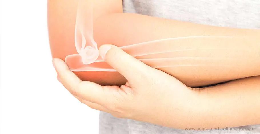 ¿Qué es la artritis?