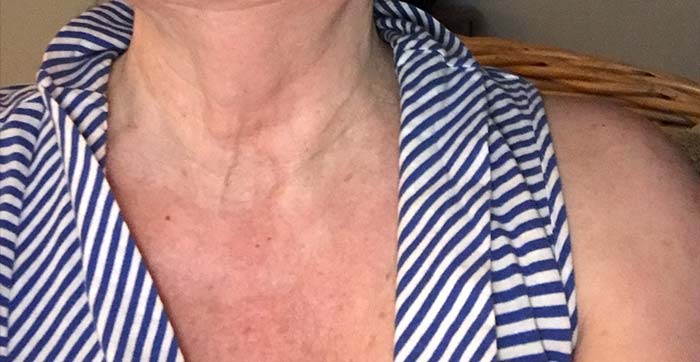 wrinkles schminkles review