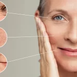wrinkles: types, causes, & treatments