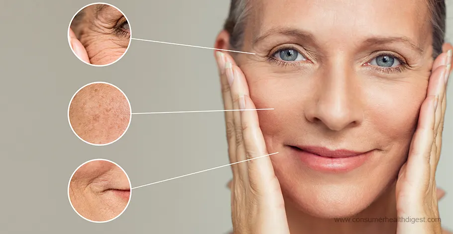 Exploring the Diversity of Wrinkles: Types, Causes, & Treatments